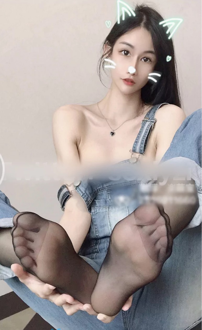 ald1重庆1.0！黑根霉图片
